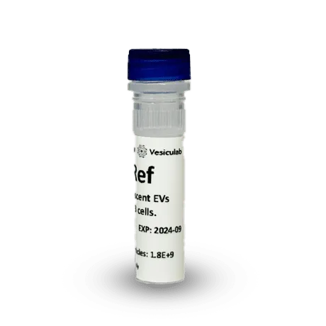 Vesi-Ref CD63-GFP