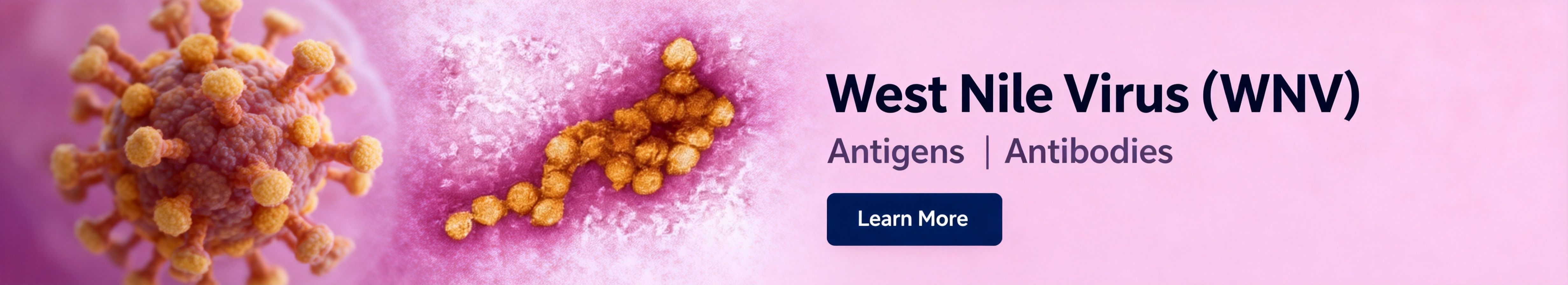 West Nile Virus (WNV).jpg