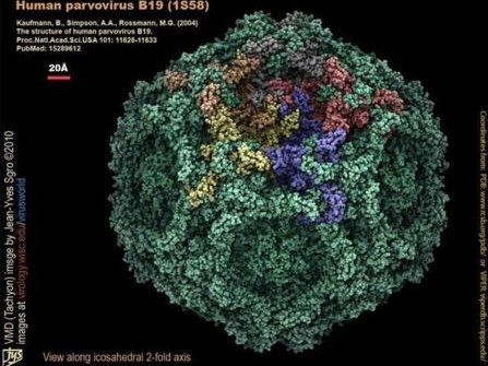 Human Parvovirus B19.jpeg