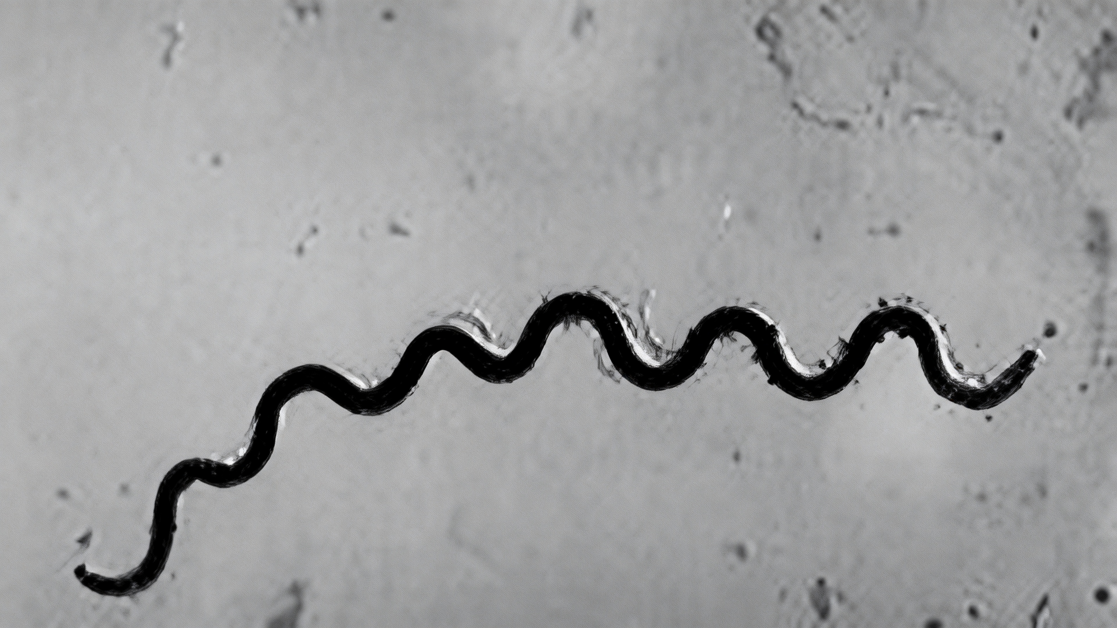 Treponema pallidum.jpg