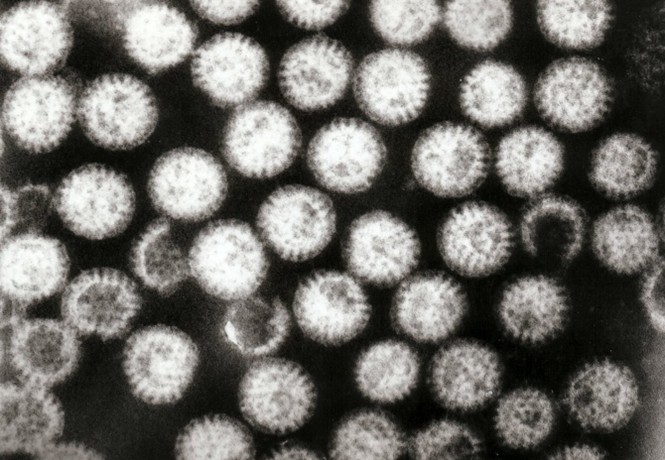 Rotavirus A（RV-A）.jpg
