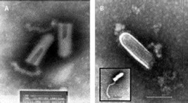 Chandipura virus（CHPV）.jpg