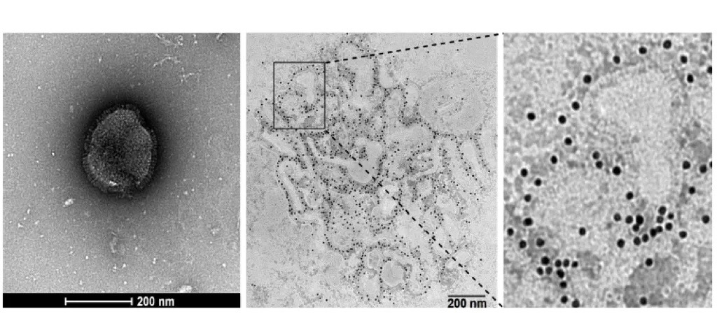 Human Metapneumovirus.jpeg