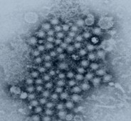 Bovine viral diarrhea virus（BVDV）.jpg