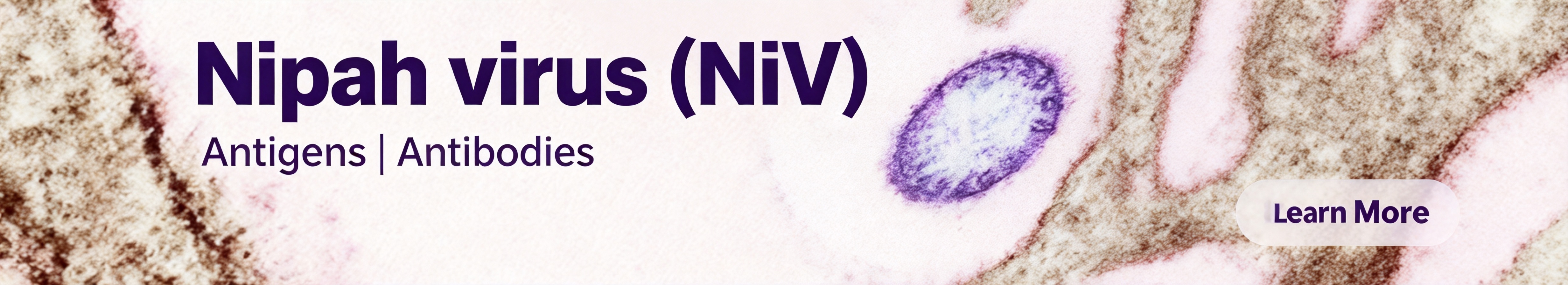 Nipah virus（NiV）.jpg