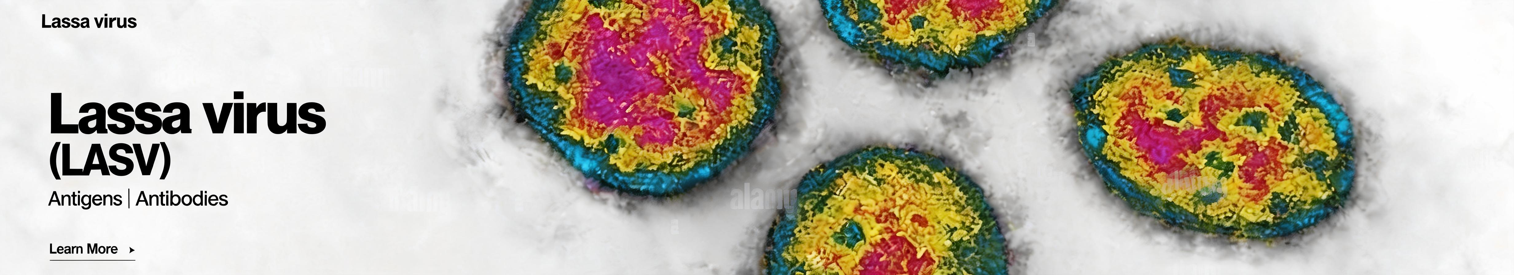 Lassa virus（LASV）