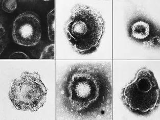 Varicella-Zoster Virus 
