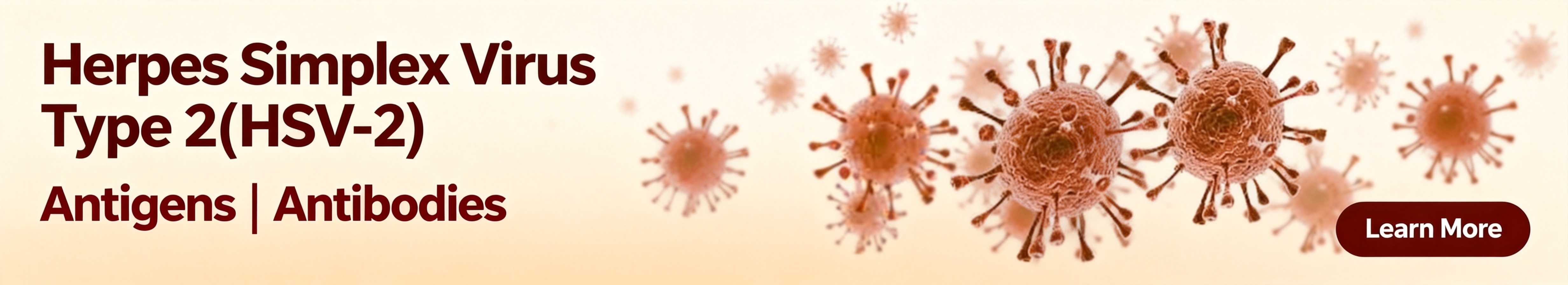 Herpes Simplex Virus Type 2 (HSV-2)