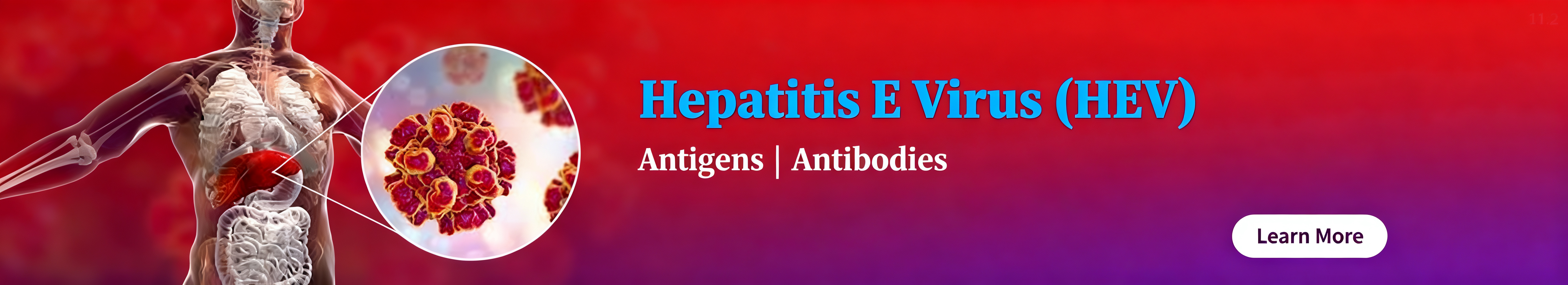 Hepatitis E Virus (HEV)