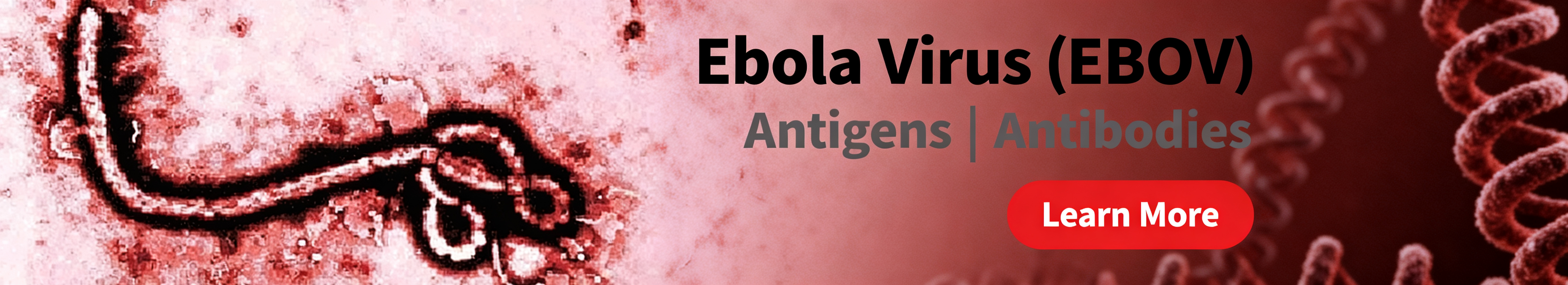 Ebola Virus (EBOV)