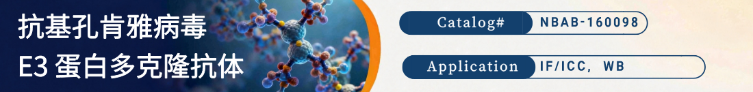 抗Chikungunya Virus E3, CHIKV抗体