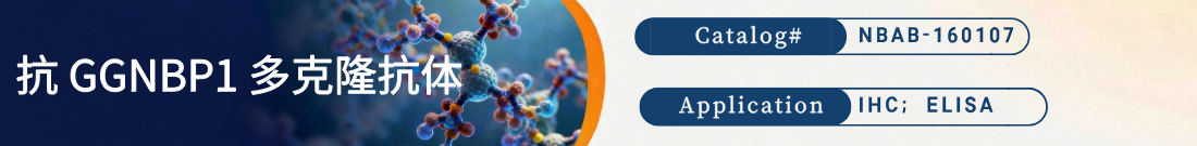 抗GGNBP1抗体 抗GGNBP1抗体