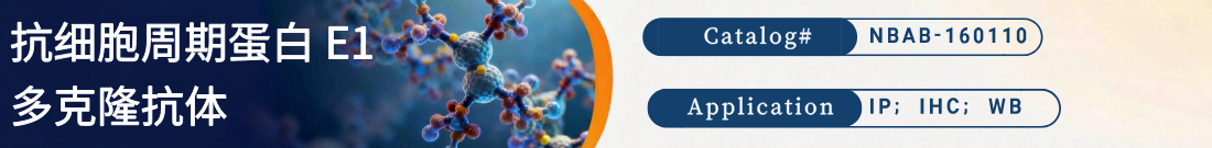 抗Cyclin E1抗体 | Anti-Cyclin E1 Polyclonal Antibody