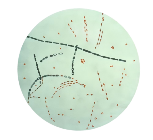 Bacillus anthracis